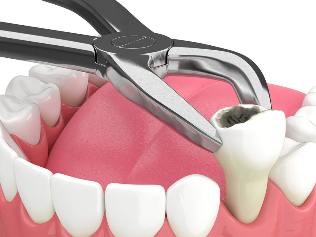 dentist in pudukkottai