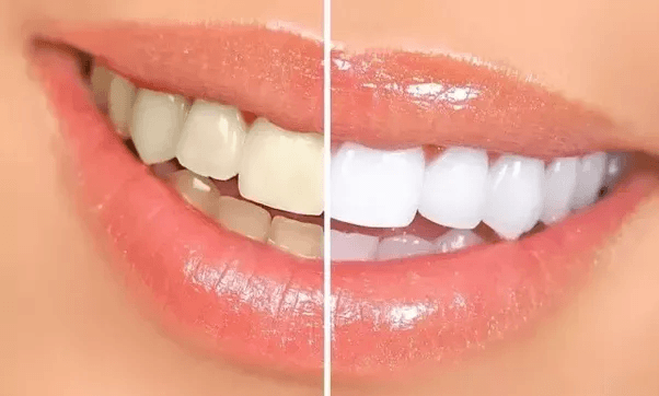 dental clinic in pudukkottai